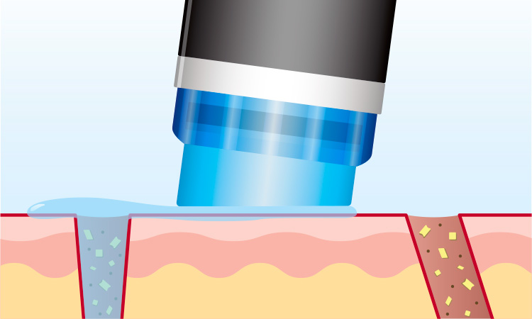 クレンジング+ピーリング