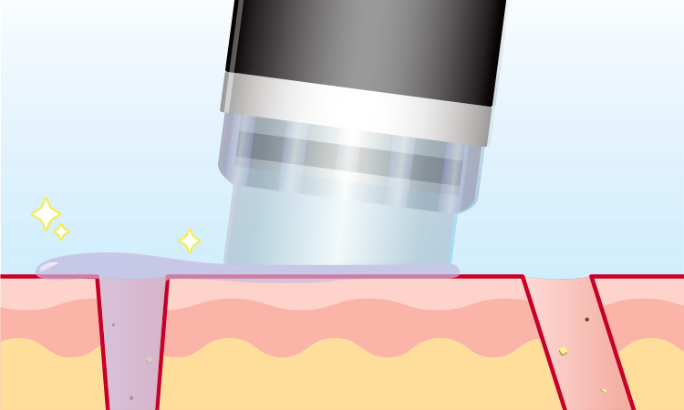 美容液導入+保護