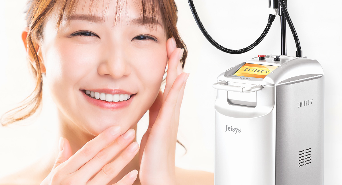 IPL光治療(セレックV)