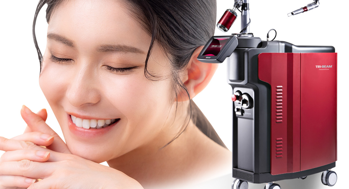 QスイッチYAGレーザー