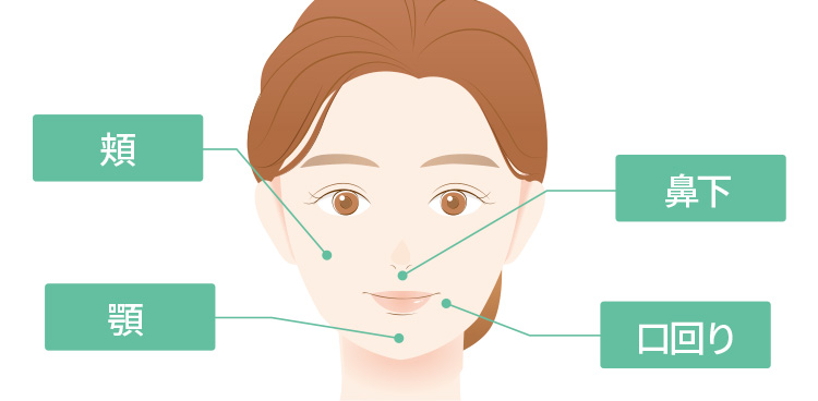 ダウンタイムが少ない