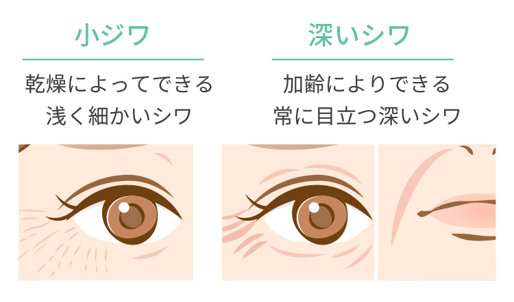 ダウンタイムが少ない画像